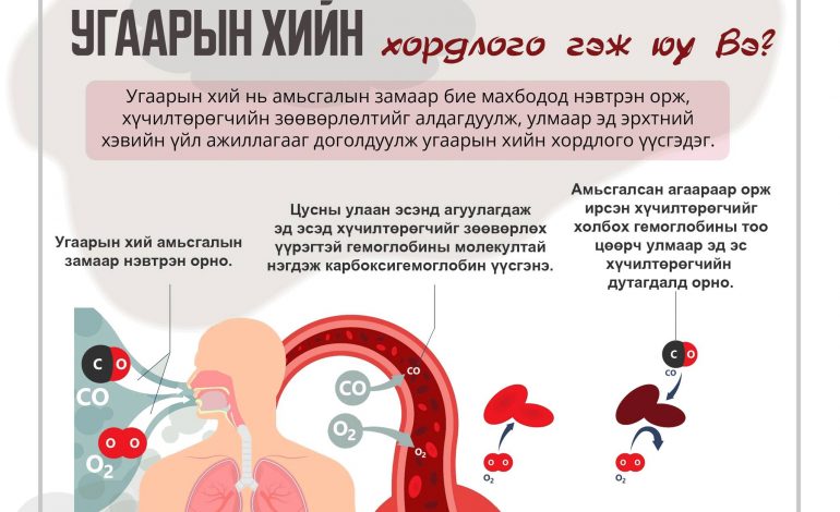 УГААРЫН ХИЙН ХОРДЛОГООС СЭРГИЙЛЬЕ